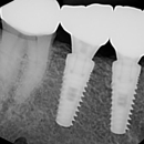 Burbank Dental Center - Prosthodontists & Denture Centers