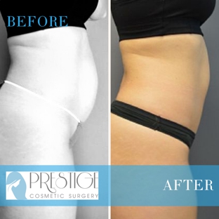 Prestige Cosmetic Surgery - New Braunfels, TX