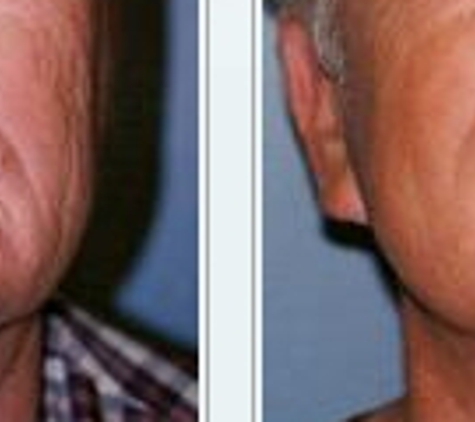 Plastic Surgery Center of Glendora - Dr. Jon I Sattler, MD - Glendora, CA