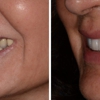 AH Smiles: Brent A. Engelberg, DDS gallery