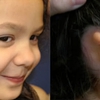 Microtia Congenital Ear Institute gallery