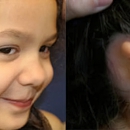 Microtia Congenital Ear Institute - Clinics