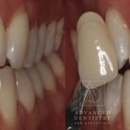 Advanced Dentistry and Aesthetics - Implant Dentistry