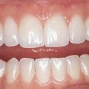 TLC For Gums - Gordon Wilson, DDS - Periodontists