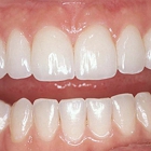 TLC For Gums - Gordon Wilson, DDS