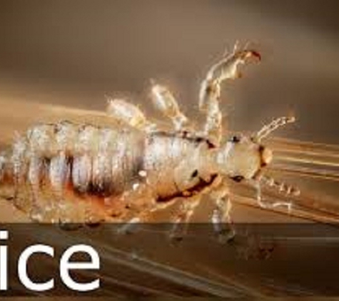 Knoxville Lice Removal Services-Specialized Hair Care - Knoxville, TN