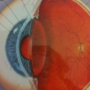 Newark Optometry - Contact Lenses