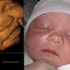 Jacksonville 4D Fetal Photo gallery