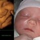 Jacksonville 4D Fetal Photo