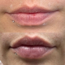 More than Lip Service - Hair Removal