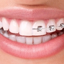Full Smile Orthodontics