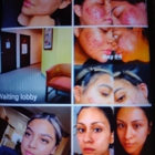 THE FACIAL COMPANY ACNE CLINIC