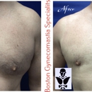 Boston Gynecomastia Specialists - Physicians & Surgeons, Cosmetic Surgery