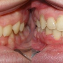 Allegany Orthodontics - Orthodontists