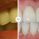 Dental Expressions - Dental Hygienists