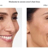 Cusimano Plastic Surgery | Baton Rouge gallery