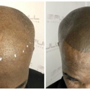 Full Micropigmentation - Physicians & Surgeons, Dermatology