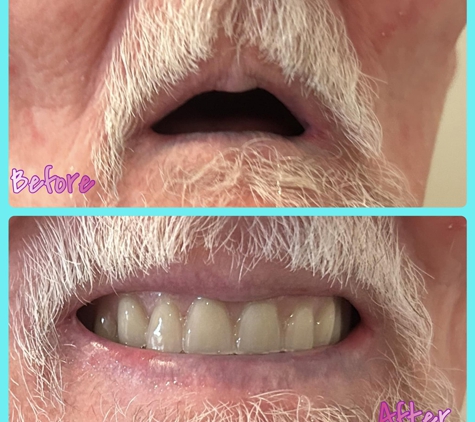 AB Denture Clinic & Mouthguard Centre - Karabar, NSW