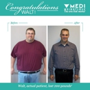 Medi-Weightloss of Brentwood - Weight Control Services