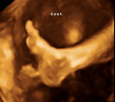 TLC Imaging 3D/4D Ultrasounds - Reynoldsburg, OH