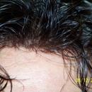 Marlene Glass Hair Restoration Inc - Hair Replacement