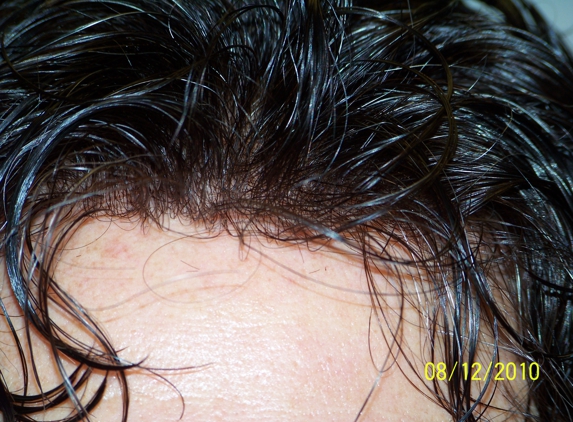 Marlene Glass Hair Restoration Inc - Ocala, FL