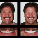 Lehigh Valley Smile Designs - Michael A. Petrillo DMD, PC - Cosmetic Dentistry