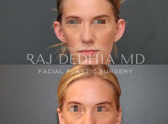 Raj Dedhia, MD Facial Plastic Surgery - San Francisco, CA