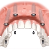 Progressive Periodontics and Implant Dentistry gallery