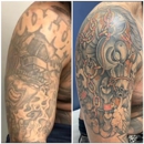 MEDermis Laser Clinic - Austin - Tattoo Removal