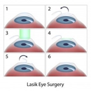 Akler Eye Center - Physicians & Surgeons, Ophthalmology