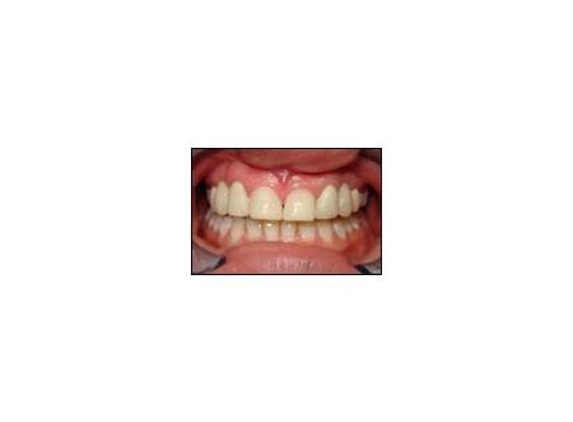 Carseldine Dental - Carseldine, QLD