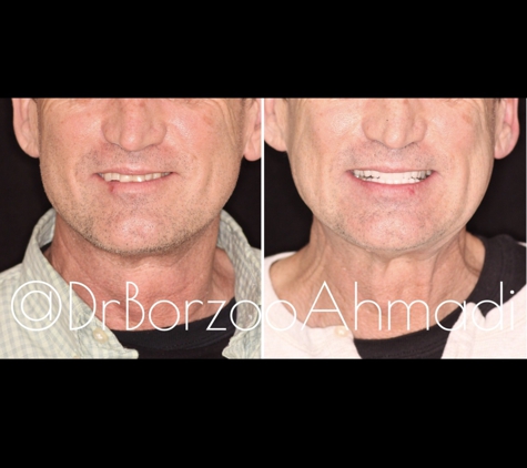 Dr. Borzoo Ahmadi DDS - West Hollywood, CA