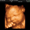 3D Baby Ultrasound Studio - Medical Imaging Services
