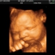 3D Baby Ultrasound Studio