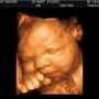 3D Baby Ultrasound Studio