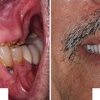 William P. Lamas, DMD - Periodontics & Dental Implants gallery