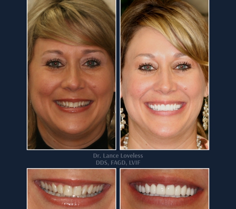 Bridgeview Dental - Austin, TX