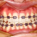 In Smyle Dental - Prosthodontists & Denture Centers