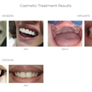 Advanced Dental Center - St. Matthews - Dental Hygienists