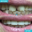 Brentwood Dental Care - Implant Dentistry