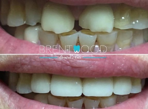 Brentwood Dental Care - Los Angeles, CA