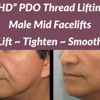 Renew Body Contouring & Medspa gallery