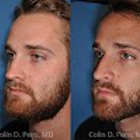 North Texas Facial Plastic Surgery