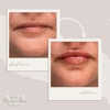 Wilkes Rejuvenation MD gallery