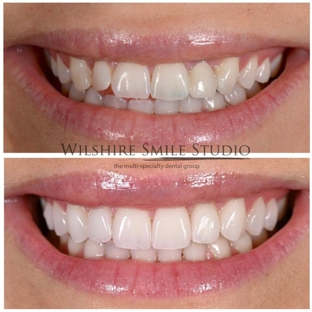 Wilshire Smile Studio - Los Angeles, CA