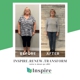 Inspire Bariatrics