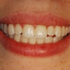 Elite Prosthetic Dentistry: Dr. Gerald M. Marlin gallery