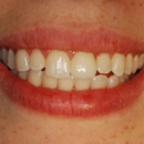 Elite Prosthetic Dentistry: Dr. Gerald M. Marlin - Dentists