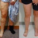 Amerivein - Physicians & Surgeons, Vascular Surgery